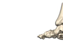 Bolest Achillovy šlachy